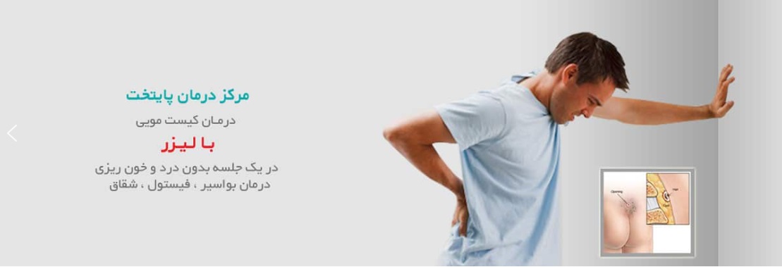 مرکز لیزر کیست مویی